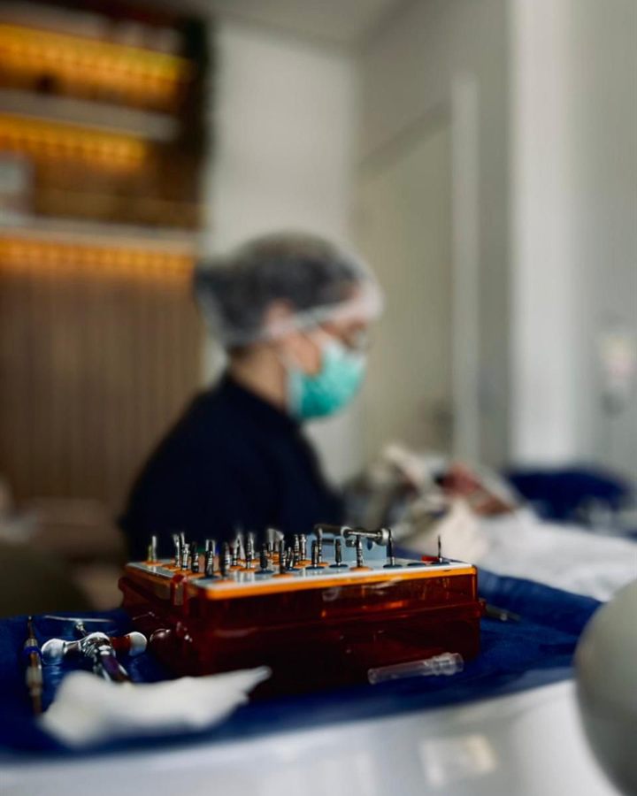 Implante dentário na WI Odontologia